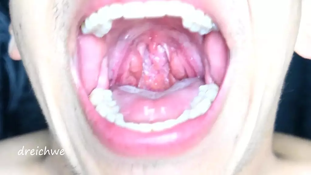 exciting uvula