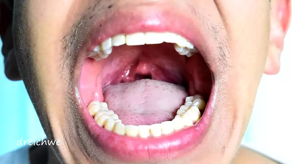 deep and exciting uvula