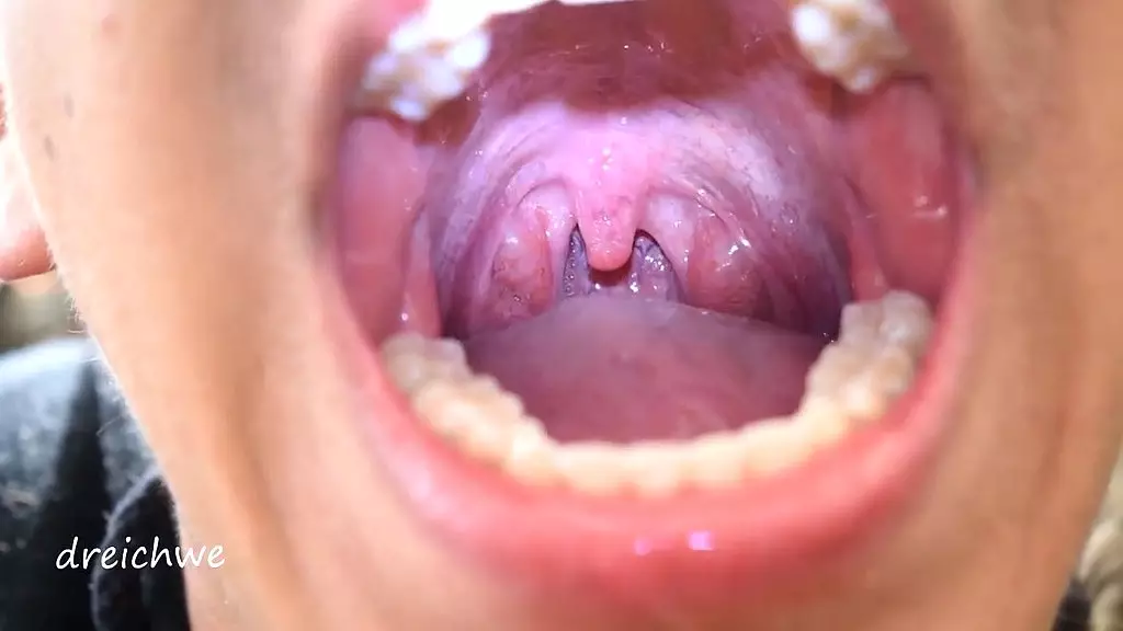 uvula fetish
