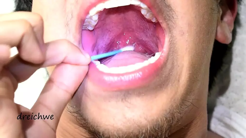 touching the uvula with swabs