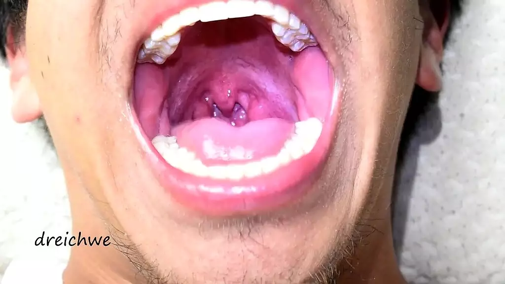deep uvula