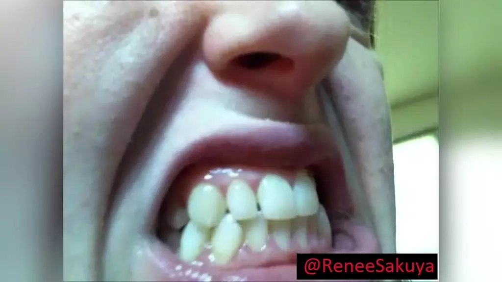 upclose inside look of her mouth and teeth, fetish video
